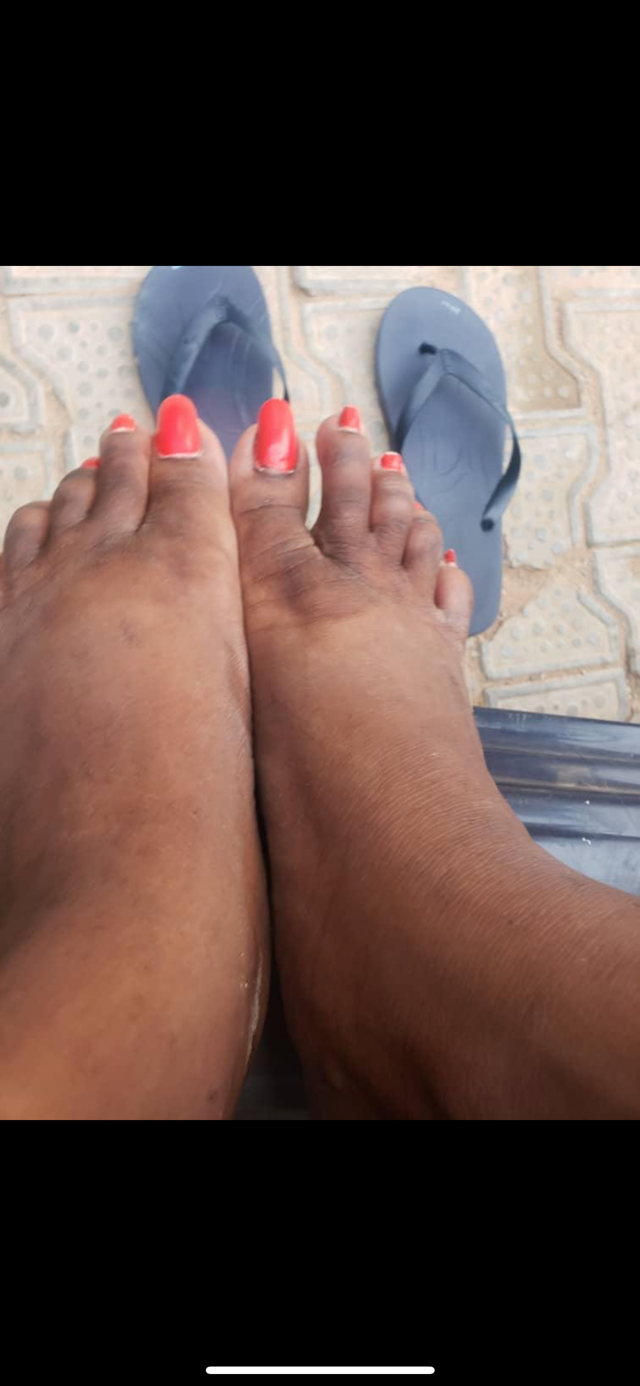 Dark Knuckle Removal Set