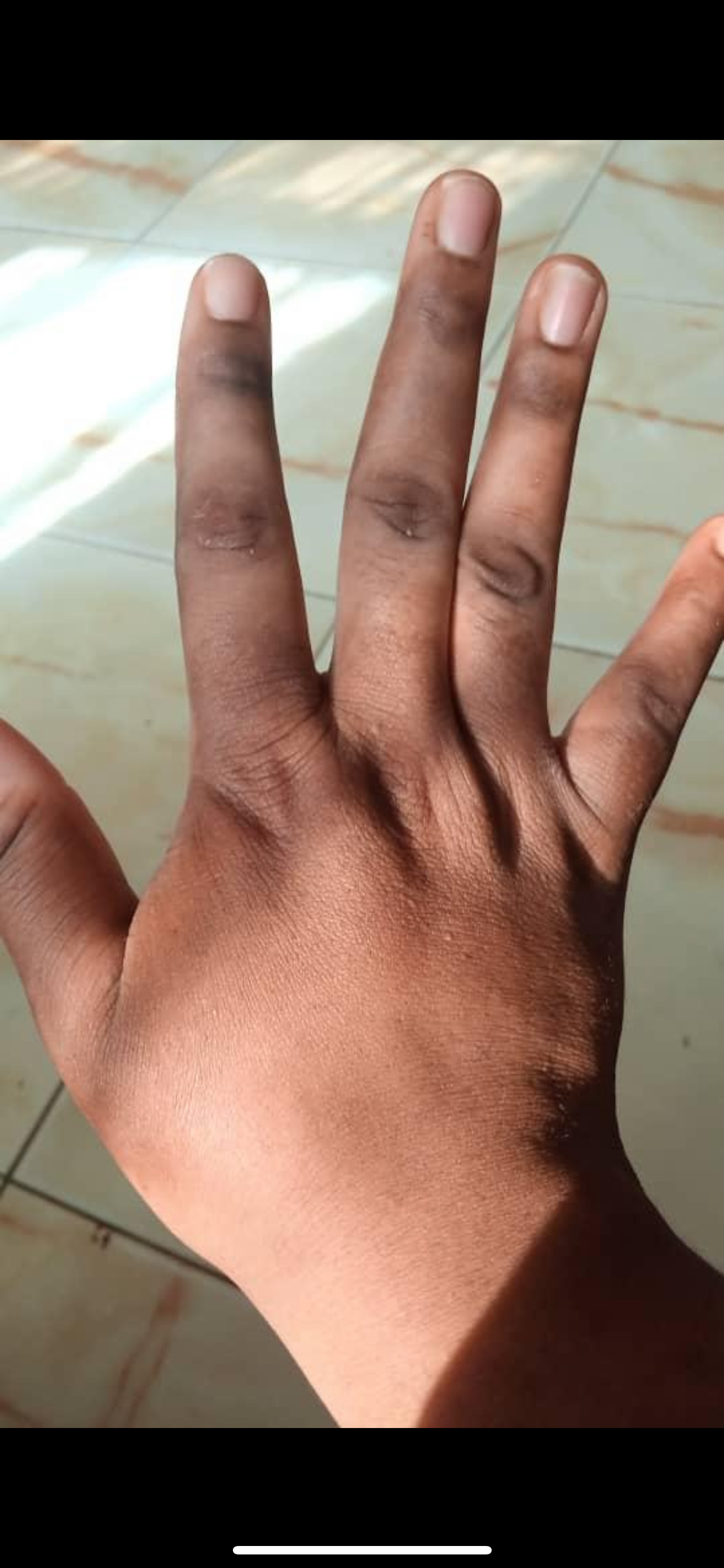 Dark Knuckle Removal Set