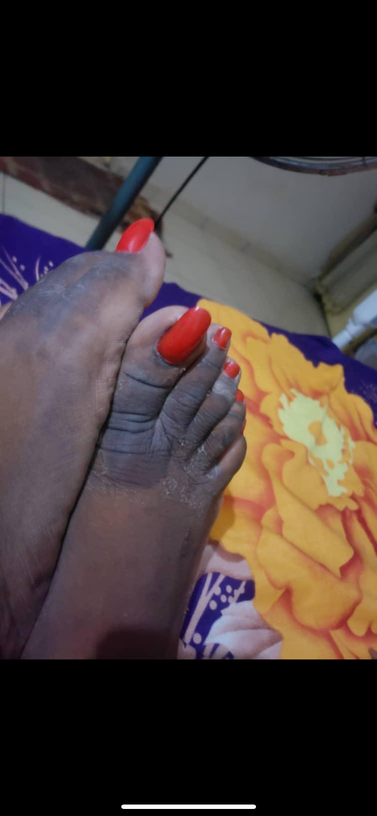 Dark Knuckle Removal Set